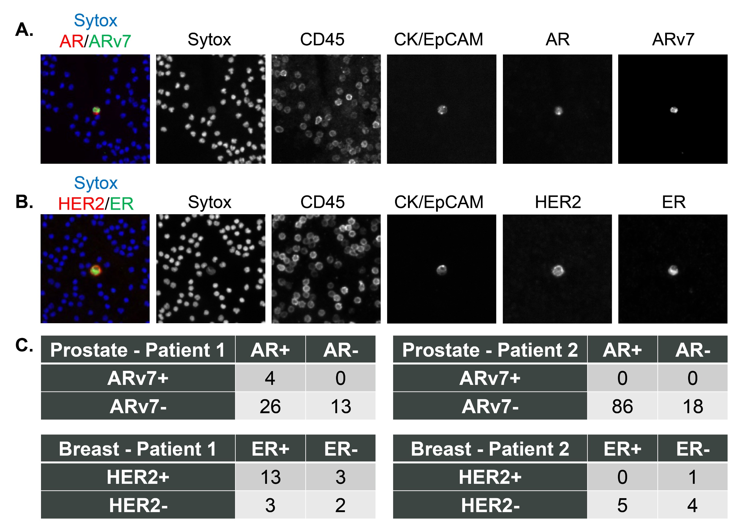  Clinical samples stained using the base epithelial CTC detection assay and two additional biomarkers.   