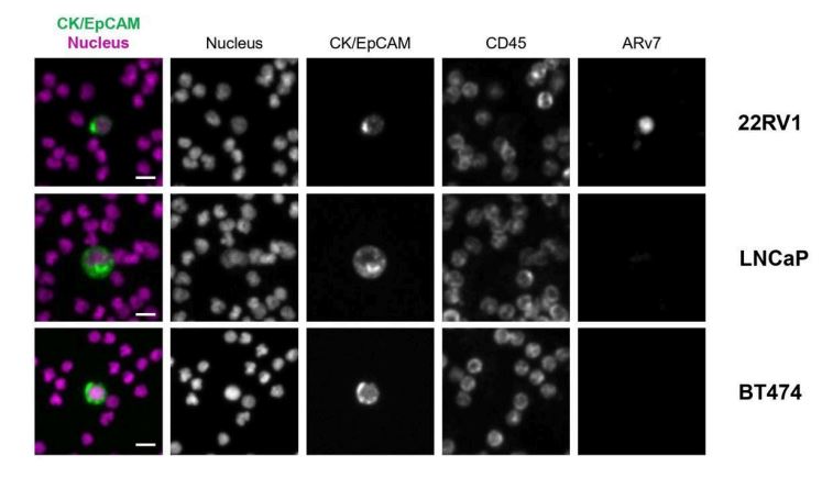  mCTC stained for ARv7